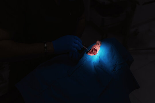 A close-up of a patient during a dental procedure. The mouth is illuminated by a bright blue lamp, while the doctor's blue-gloved hands work with a dental instrument. This emphasizes precision and hyg