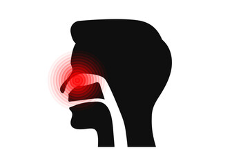Stuffy nose. Clogged nose due to flu or a viral or bacterial infection. Healthcare. Influenza concept. Isolated vector illustration.