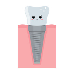 A dental implant, a kawaii character. Screw prosthesis, Illustration of dental implantation,orthodontic dental implantation