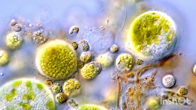 Microscope view of Microalgae cells, pond water sample 