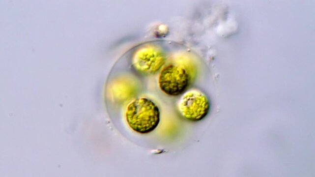 Green algae cells, microscopic view 400x