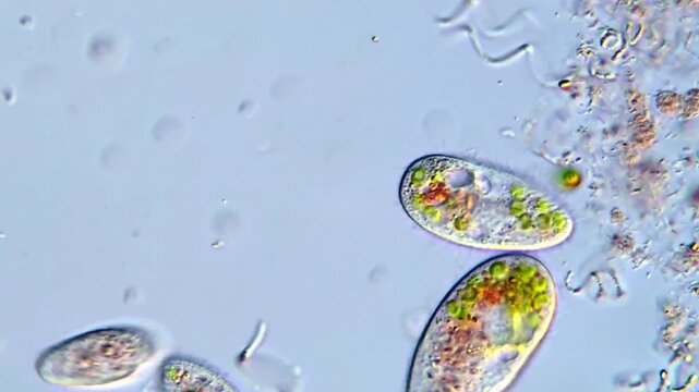 Green ciliate microorganism and spirochetes under microscope view 