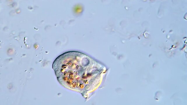 Microorganism in pond water under microscope, High Resolution video 