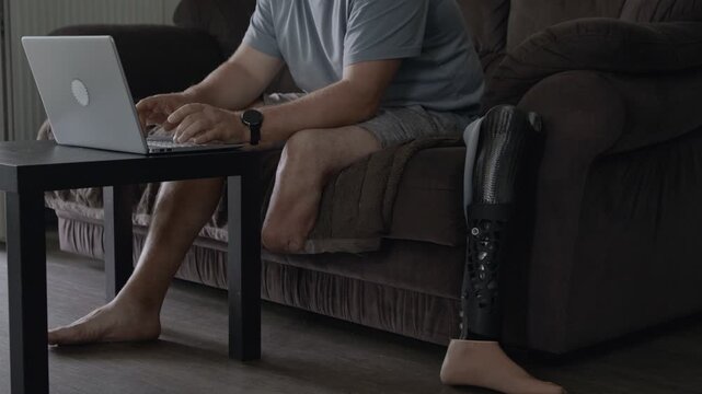 An adult male amputee sits on a sofa working on his laptop while his carbon fiber prosthetic leg lies in the foreground.