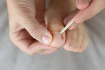 close up of hands using a wooden stick to clean or push back a toenail cuticle concept of pedicure, foot care, beauty salon