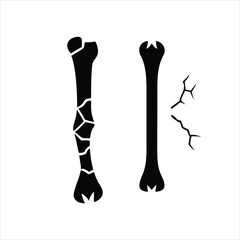 Clean vector illustration of a human long bone on a white background