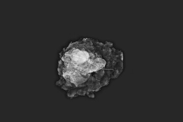 Mammography that shows breast cancer. 