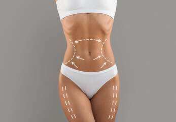 Body Contouring Concept. Cropped Shot Of Slim Female Torso With Drawn Lifting Up Lines On It,...