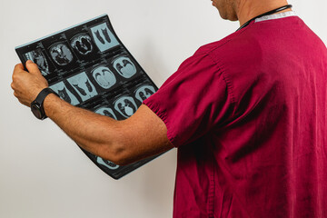 Medical professional examines X-ray images in a clinical setting