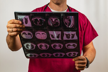 Medical professional examines diagnostic imaging in clinical setting