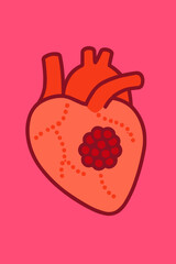 A flat vector illustration of a thrombosis clot in a stylized heart, designed for cardiovascular health campaigns