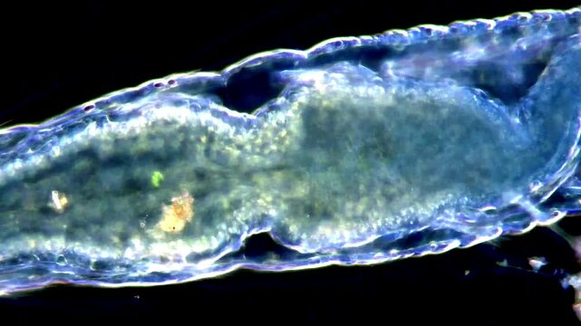 4K Microbiology Video of Aeolosoma Worms,  dark field microscope 