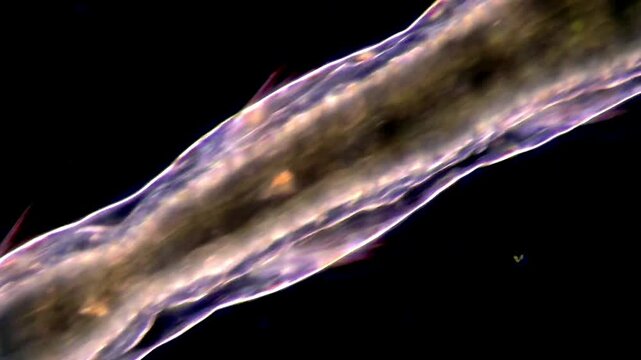 Microorganism under dark field microscope, Aeolosoma Worms