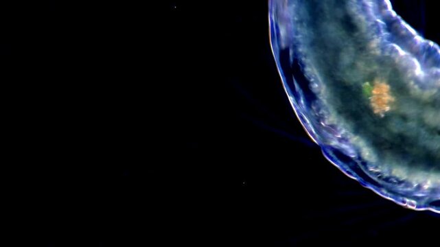 Transparent Aeolosoma Worm Moving Under dark field Microscope