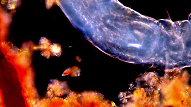 Flatworm under dark field microscope 