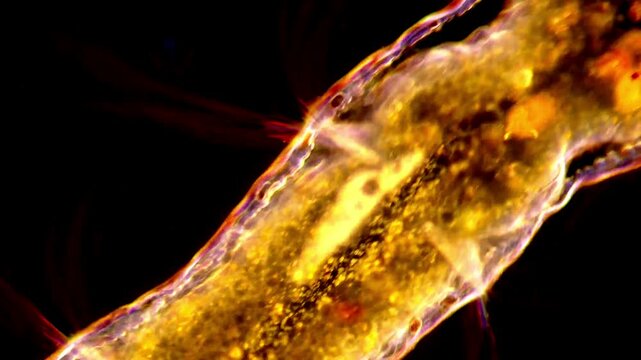 Microscopic View of Aeolosoma Worms in 4K Detail,  darkfield microscopy 