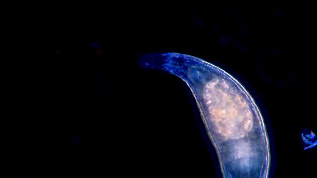 Turbellarian flatworm under dark field microscope