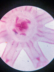 Microscopic View of Aurelia Ephyra Stages