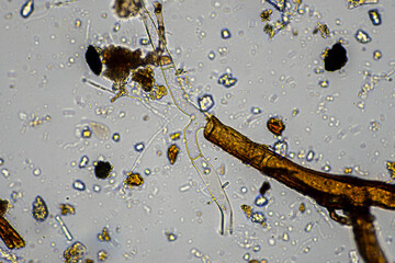 australian regenerative agriculture soil microorganisms and soil biology, with nematodes and fungi under the microscope. in a soil and compost sample