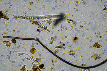 australian regenerative agriculture soil microorganisms and soil biology, with nematodes and fungi under the microscope. in a soil and compost sample