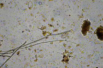 bugs in living soil microbes organisms in a soil and compost sample, fungus and fungi and under the microscope in regenerative agriculture. in australia.