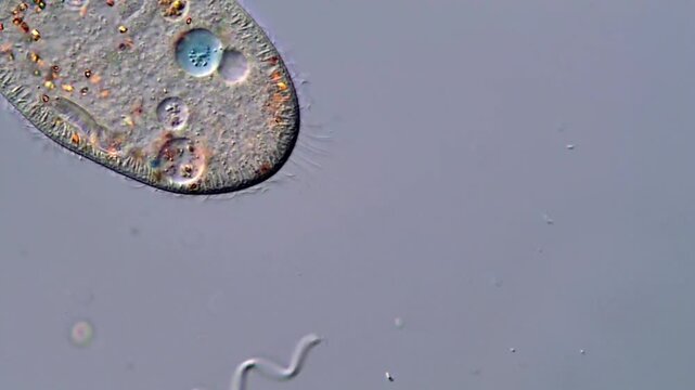 Movement of freshwater microorganism under microscope, paramecium ciliophora 