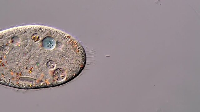 Protozoa under microscope, paramecium microorganism under microscopy 