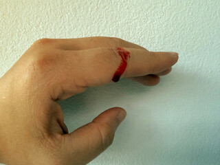Finger on left human hand was cut by knife during cooking. Blood bleeding with red blood from fresh wound