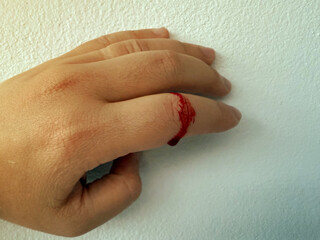 Finger on left human hand was cut by knife during cooking. Blood bleeding with red blood from fresh wound