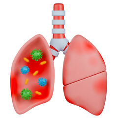 3D medical illustration of an infected human lung showing inflammation and various viruses and bacteria inside.
