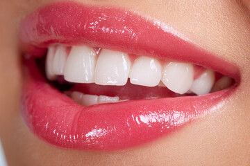 Obraz premium Close-up of a fresh glossy pink lip makeup on a smiling mouth showing natural white teeth and smooth skin texture for beauty concept