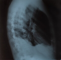 chest X-ray