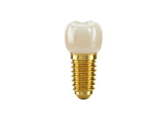 Dental implant isolated on transparent background, artificial tooth with golden screw for stomatology and prosthetics
