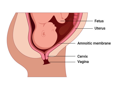 Cervical Effacement and Dilation. Various processes in the Uterus during Childbirth. Thinning and shortening of the Cervix. Detailed medical vector illustration. The fetus is in the uterus
