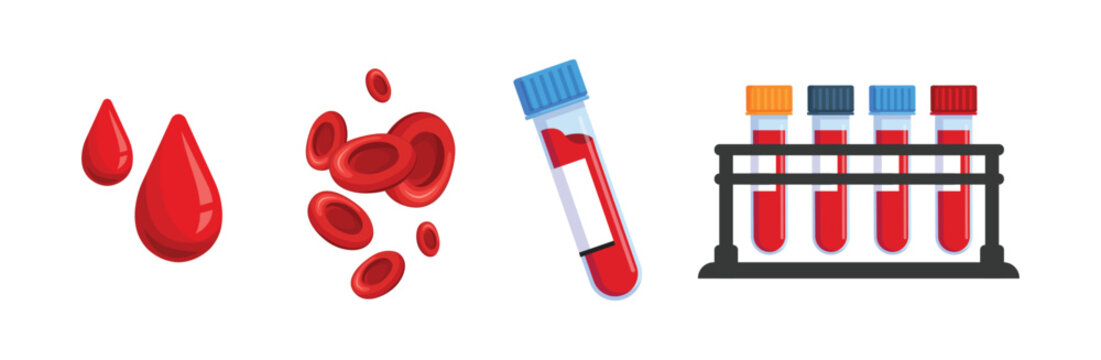 Medical test tubes with blood samples. The patient's blood in pipettes for analysis. Laboratory research concept for biochemistry and viruses. Blood donation. Blood cells plasma Vector isolated.
