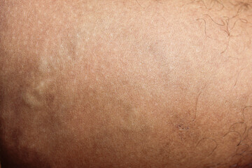 Asian man skin texture close up. Man with tan skin