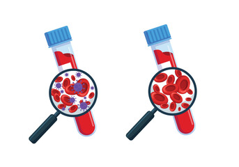 Set of laboratory blood test for infection.  magnifying glass and test tube with blood sample to research and find viruses and bacteria in hematology analysis cartoon vector illustration  © Erfindadwi