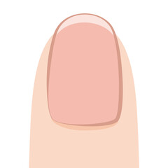 爪半月がない爪