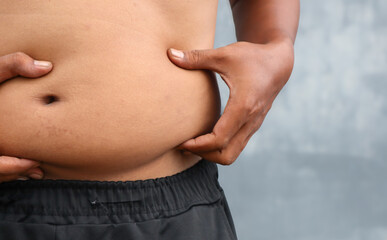 Naklejka premium A fat man shows fat deposits on his stomach. Reduction of overweight and obesity treatment. Healthy lifestyle.