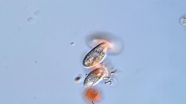 Stunning 4K Footage of Ciliate Protozoa Under Microscope
