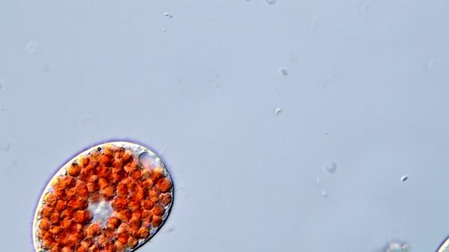 Educational Biology Video: Protozoa Ciliates 4K Microscope