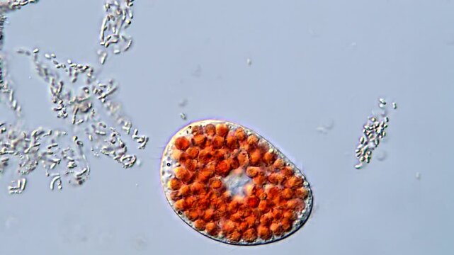 Red protozoa under microscope, Ciliate protists 