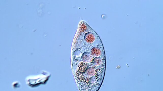 Protozoa under DIC microscope, Ciliates Ciliophora 