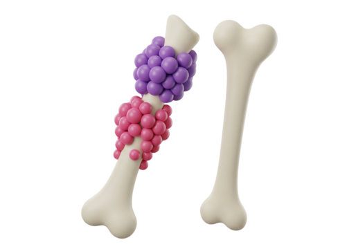 Bone Pathology Illustration: Healthy Bone vs. Bone with Abnormal Growths