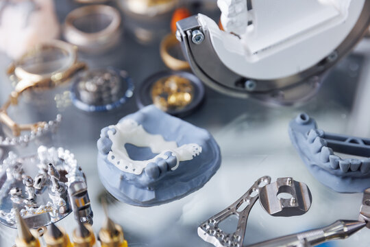Exhibition examples of dental prostheses, titanium crowns and platforms for pins made on mini CNC milling machine