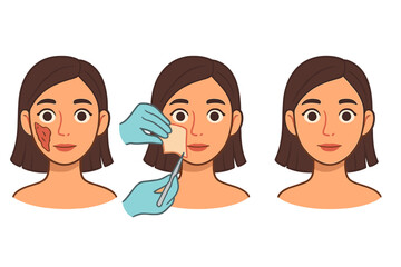 Artificial skin creation process, transplantology treatment, girl’s face skin restoration, damaged skin healing, cosmetic surgery, medical procedure, vector cartoon illustration