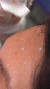 Beautician doctor makes botulinum toxin injection in the forehead of young beautiful woman. Close up vertical 4k shot