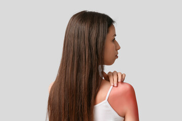 Allergic young woman with red sunburned skin on grey background