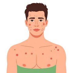Fototapeta premium Illustration of a young man with acne on his face and upper body