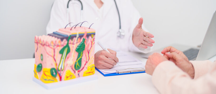 woman Patient consultation Dermatologist with anatomy of skin and hair. Skin disease and Hair loss, Systemic Lupus Erythematosus or SLE, world lupus day, May Melanoma and Skin Cancer Awareness month